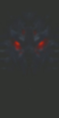 Witcher V10